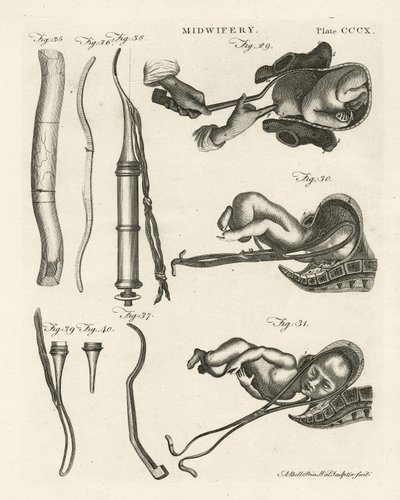 Obstétrique, illustration de 